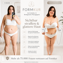 Lade das Bild in den Galerie-Viewer, Formkur - Anti-Cellulite Massagegerät für Bauch, Beine & Po