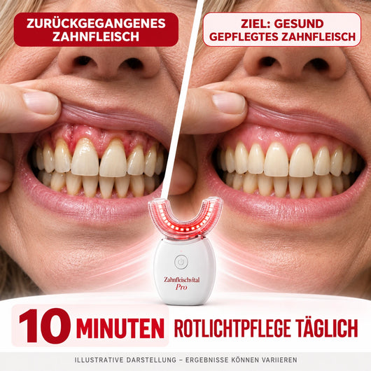 Zahnfleischvital Pro - Zahnfleisch wieder aufbauen in nur 10 Minuten pro Tag