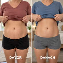Lade das Bild in den Galerie-Viewer, Formkur - Anti-Cellulite- &amp; Bindegewebs-Massagegerät

