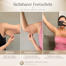 Lade das Bild in den Galerie-Viewer, LumaLift Pro - Gerät zur Formung und Straffung von Armen &amp; Körper