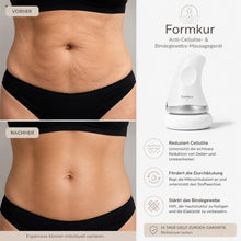 Lade das Bild in den Galerie-Viewer, Formkur - Anti-Cellulite- &amp; Bindegewebs-Massagegerät
